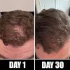 Pete & Pedro BOOST Hair & Beard Strengthening & Growth Natural Scalp Health Serum Oil For Men & Women – With Rosemary, Biotin & 20 plus Essential Oils | Shark Tank Featured, 2 oz.