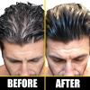 Pete & Pedro BOOST Hair & Beard Strengthening & Growth Natural Scalp Health Serum Oil For Men & Women – With Rosemary, Biotin & 20 plus Essential Oils | Shark Tank Featured, 2 oz.