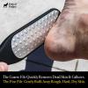 Pete & Pedro Double Sided Foot File – Men & Women Stainless Steel Pedicure Tool | Foot Care Metal Heel Scraper, Rasp, and Callus Remover | As Seen on Shark Tank